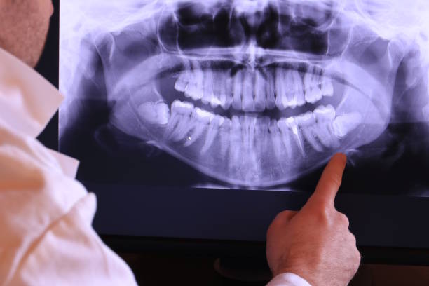 Best Emergency Dental Surgery in Garrison, ND